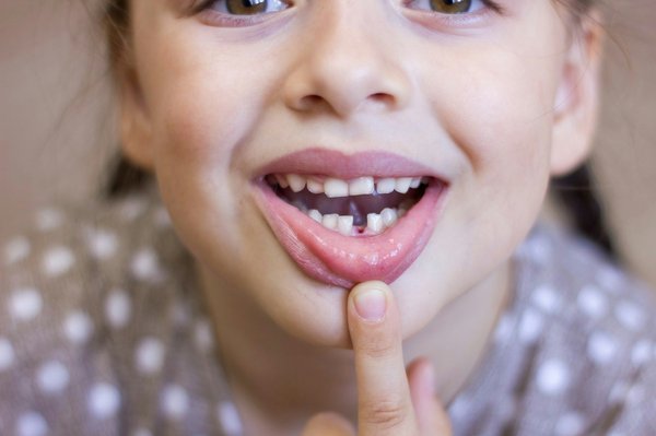 Nom des dents : découvrez la structure et les types de dents
